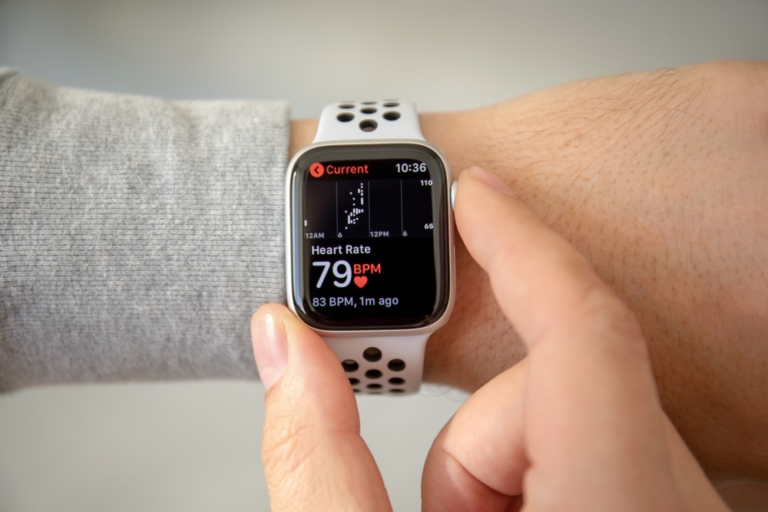 Apple Watch: Lebensretter erkennt Vorhofflimmern